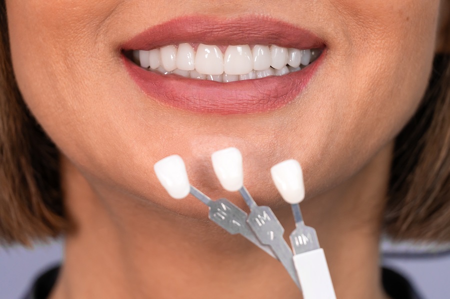 Get a Straight, Beautiful Smile With Dental Veneers